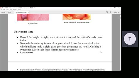 General Abdominal Assessment Lecture 5 A Youtube