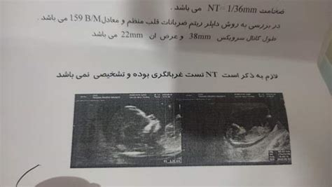 کسانی که بلدند از روی عکس ان تی جنسیتو بگن بیان تبادل نظر نی نی سایت