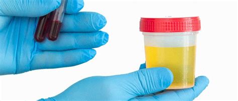 What Synthetic Urine To Use For Labcorp Drug Testing