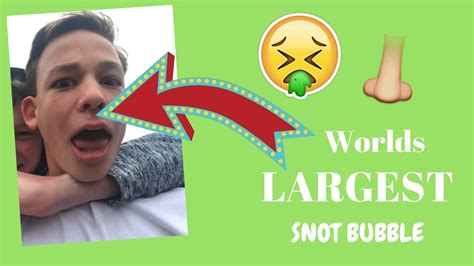 Worlds Largest Snot Bubble Youtube