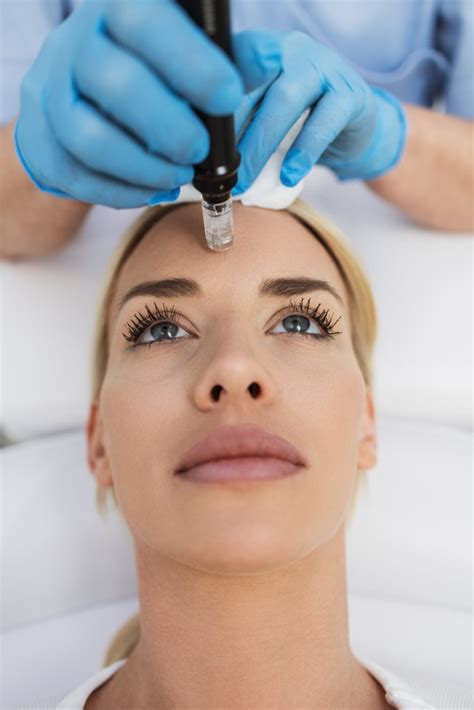 Microneedling Morali Medical Aesthetics