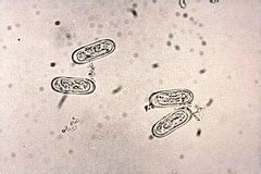 Nematodes - Spirocerca lupi flashcards | Quizlet