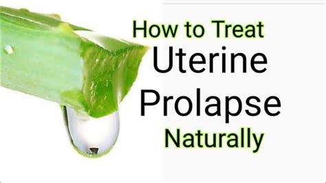 How To Treat Uterine Prolapse Pelvic Prolapse Regain Womanhood