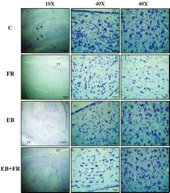 Photomicrograph Showing Cresyl Violet Stained Hypothalamic Region Of