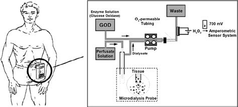 Schematic Diagram Of The Continuous Glucose Monitoring System The Download Scientific Diagram