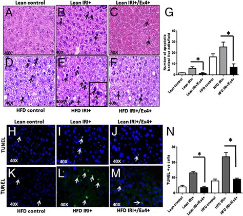 Figure 2 From The Glucagon Like Peptide 1 Receptor Agonist Exendin 4 Has A Protective Role In