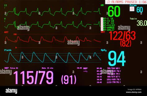 Normal Heart Rate On Blood Pressure Monitor At Thomas Overholt Blog