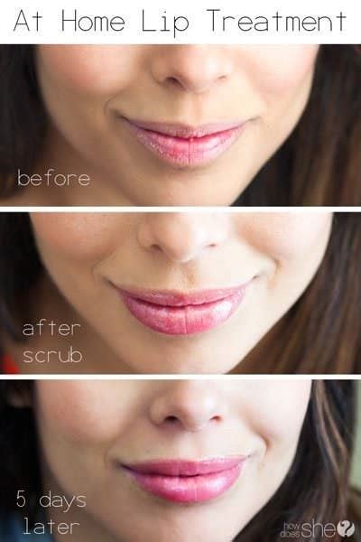 How To Get Really Smooth Lips