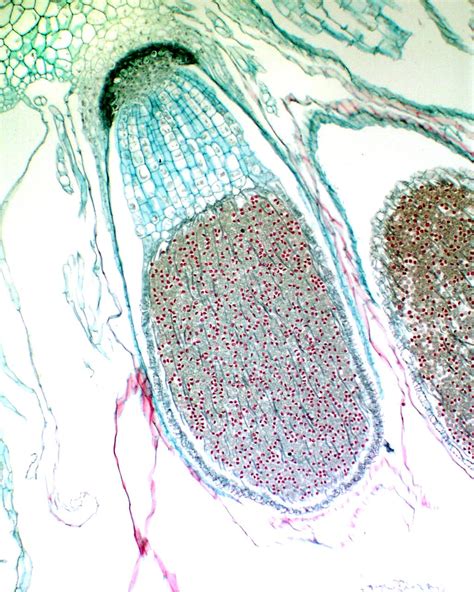 ‎Longitudinal section of attached sporophyte of Marchantia - UWDC - UW ...