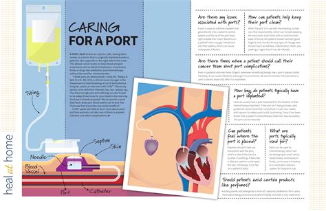 How Patients With Cancer Can Best Care For Their Chemo Port