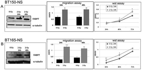 Irradiation Enhances Fabp Expression And Glioblastoma Cell Migration