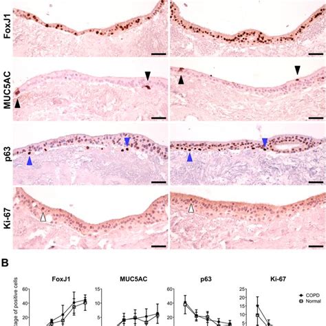 Primary Normal Human Bronchial Epithelial Cells Develop Cilia And