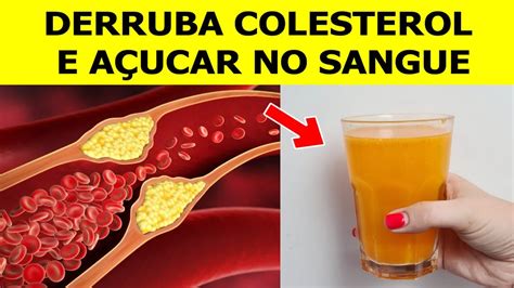 O Suco M Gico Que Derruba O Colesterol E O A Car No Sangue Youtube