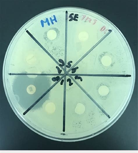 Kirby Bauer Disc Diffusion Assay Demonstrating The Antimicrobial