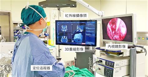 「3d定位導航」 內視鏡手術安全大升級 自由健康網