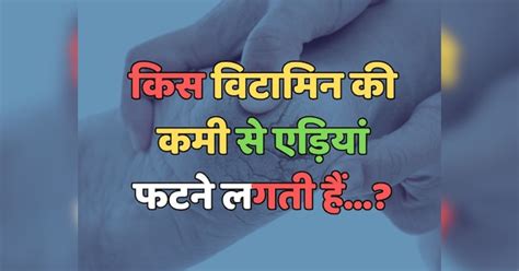 Trending Quiz किस विटामिन की कमी से एड़ियां फटने लगती हैं Trending