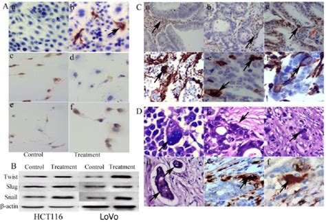 A Icc Staining Of Vimentin E Cadherin And N Cadherin A Vimentin