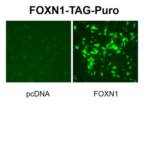 Foxn1 Reporter Lentivirus Lipexogen Biotech