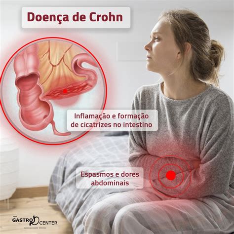 Doen A De Crohn Blog Rede Gastrocenter Belo Horizonte