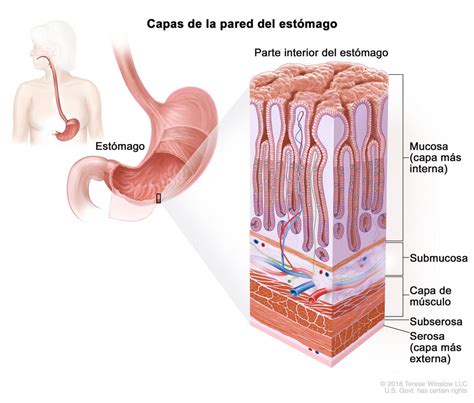 Estadios Del Cáncer De Estómago Nci