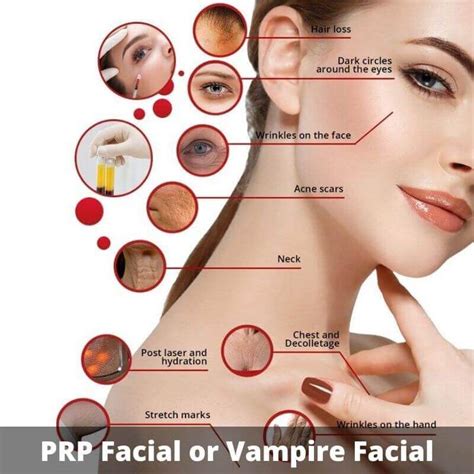 PRP Facial PRP Treatment Center