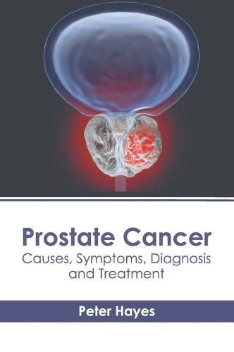 Prostate Cancer Causes Symptoms Diagnosis And Treatment By Peter