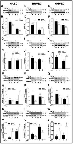 Cells Free Full Text Tissue Derivation And Biological Sex Uniquely Mediate Endothelial Cell