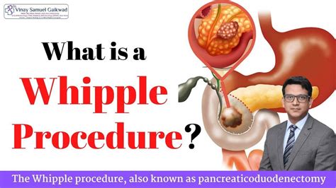 What Is Whipple Procedure Dr Vinay Samuel Gaikwad Surgical