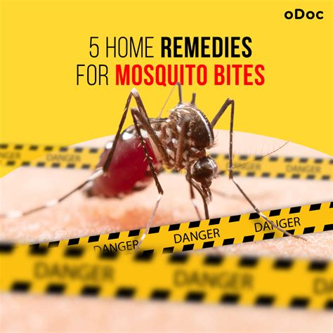 5 Best Home Remedies for Mosquito Bites - From the oDoc Blog