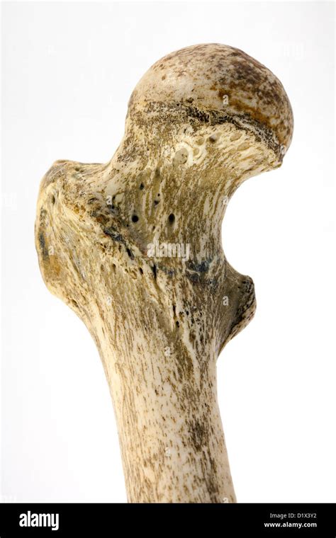 Human femur bone, close up to show the neck of femur, the commonest area to fracture in a fall ...