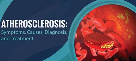 Atherosclerosis Symptoms Causes Diagnosis And Treatment Health Vision