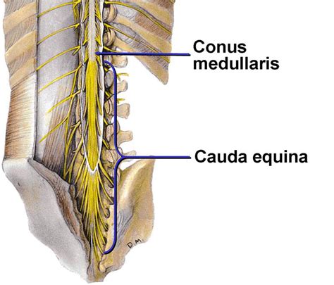 Conus medularis & cauda equina