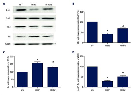 P Akt T Akt Bcl 2 And Bax Were Examined By Western Blot Analysis Download Scientific