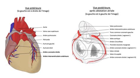 Séminaire 2 ANAT IMAGERIE Anatomie des artères coronaires imagerie