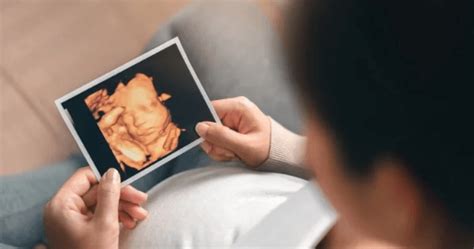 Exploring The Wonders Of 3d And 4d Ultrasound A Comprehensive Guide