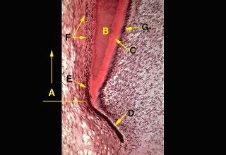 Oral Histology Digital Lab Development Formation Of The Epithelial