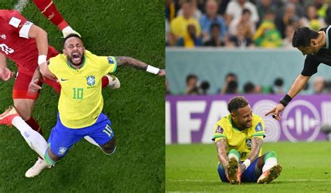 [foto] Neymar Mostró El Tobillo La Lesión Es Peor De Lo Que Se Espera