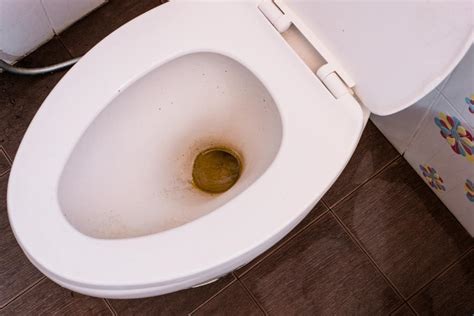 How Do I Remove Black Stains From Toilet Bowl At Joan Gonzalez Blog