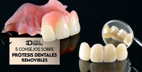 5 consejos sobre prótesis dentales removibles Clínica dental en