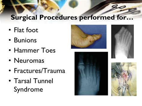 PPT - Podiatric Medicine PowerPoint Presentation, free download - ID ...