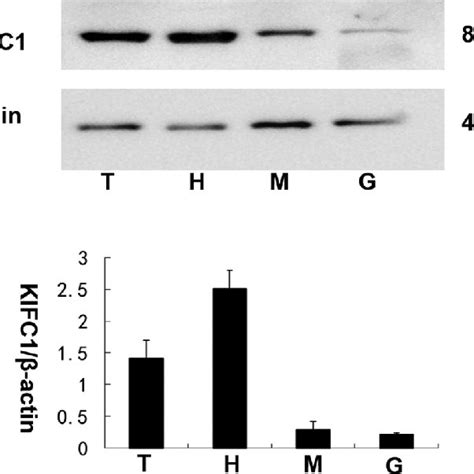 The Kifc Protein Expression Levels Among P Clarkii Tissues Kifc Was