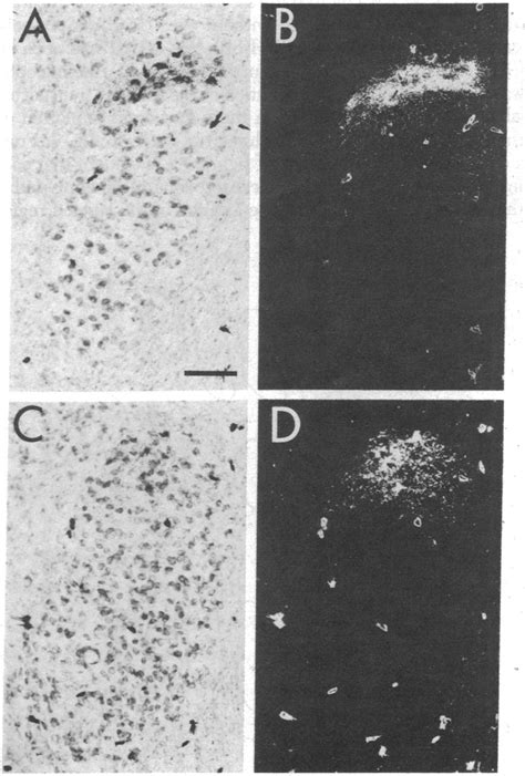 Bright And Darkfield Photomicrographs From Case BEH 8 To Show The