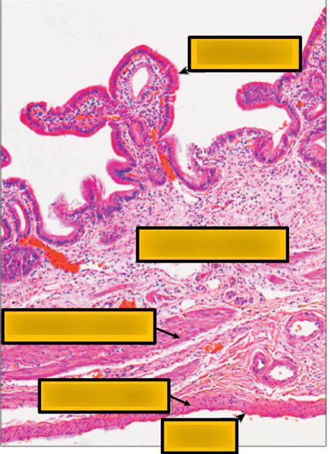 Diagram Of Low Power Gallbladder Histology Quizlet