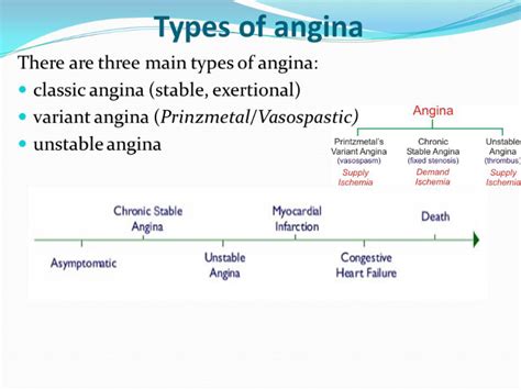 Angina Diagnosis Treatment And Consequences If Not Treated ।। হাবিজাবি