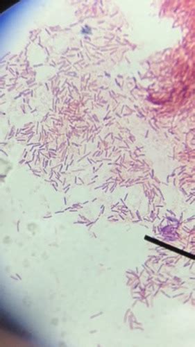 Gram Stain Microscope Lab Safety Ubiquity Aseptic Technique