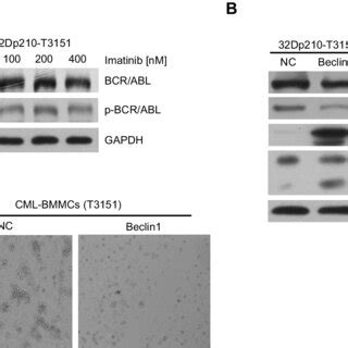 Beclin Overexpression Induced Autophagy Requires Atg And Uvrag In