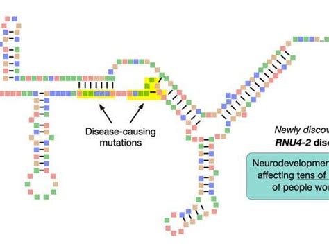 Researchers Identify A Genetic Cause Of Intellectual Disability