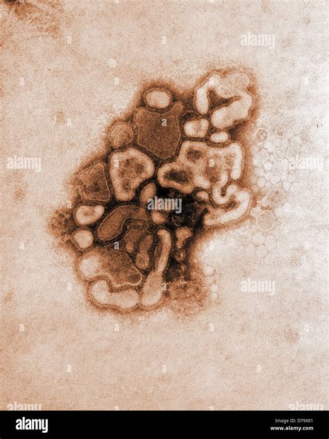 H N Virus Micrograph Hi Res Stock Photography And Images Alamy