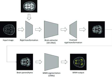 A Schematic Diagram Of The Deep Learning Based Wmh Segmentation