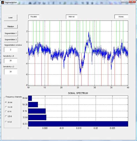 Feature Analysis Of Eeg Signals Using Som